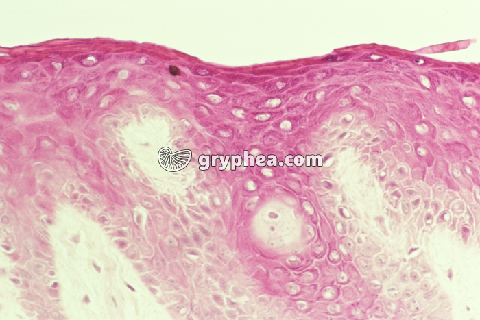 Epiderme CT x100 - gryphea.org